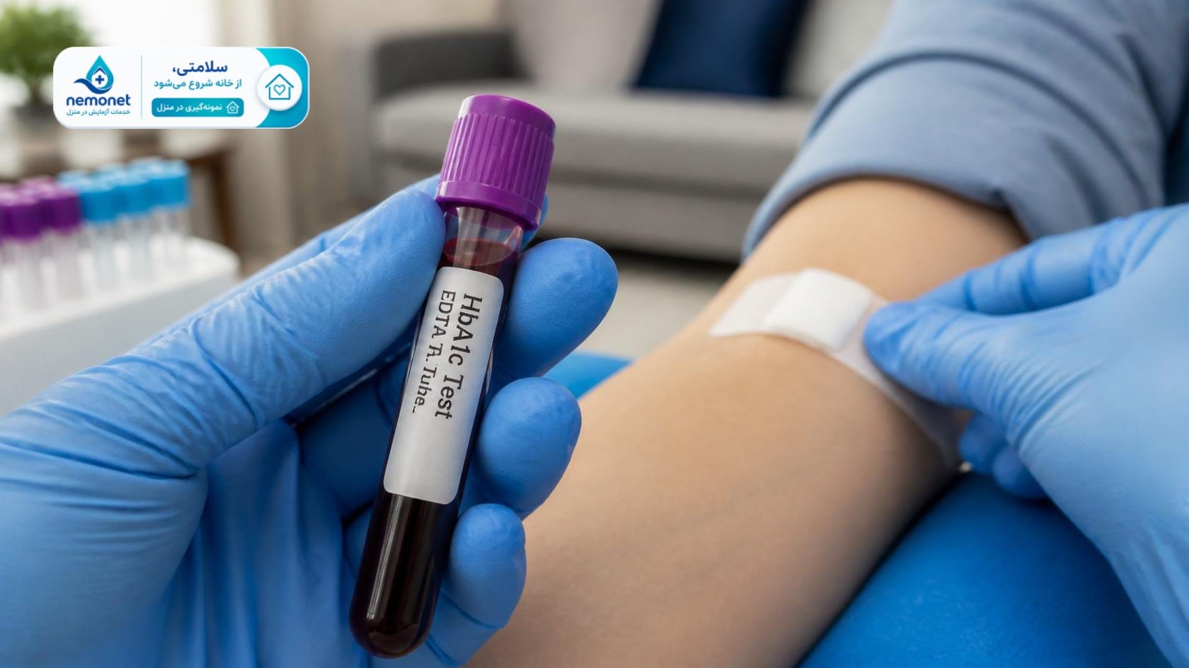 نمونهگیری آزمایش HbA1c