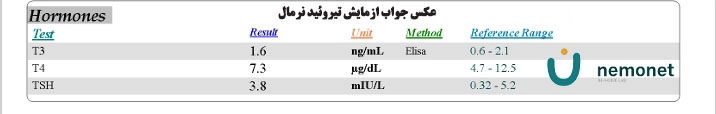 عکس ازمایش تیروئید نرمال همراه با مشخص کردن رنج طبیعی هورمون‌ها
