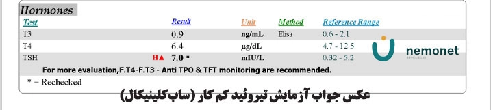عکس آزمایش تیروئید کم کار