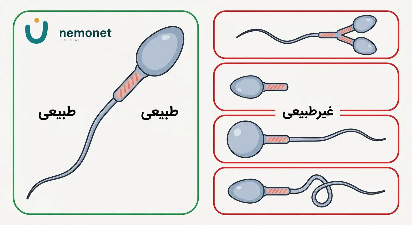 شکل اسپرم طبیعی و غیرطبیعی زیر میکروسکوپ