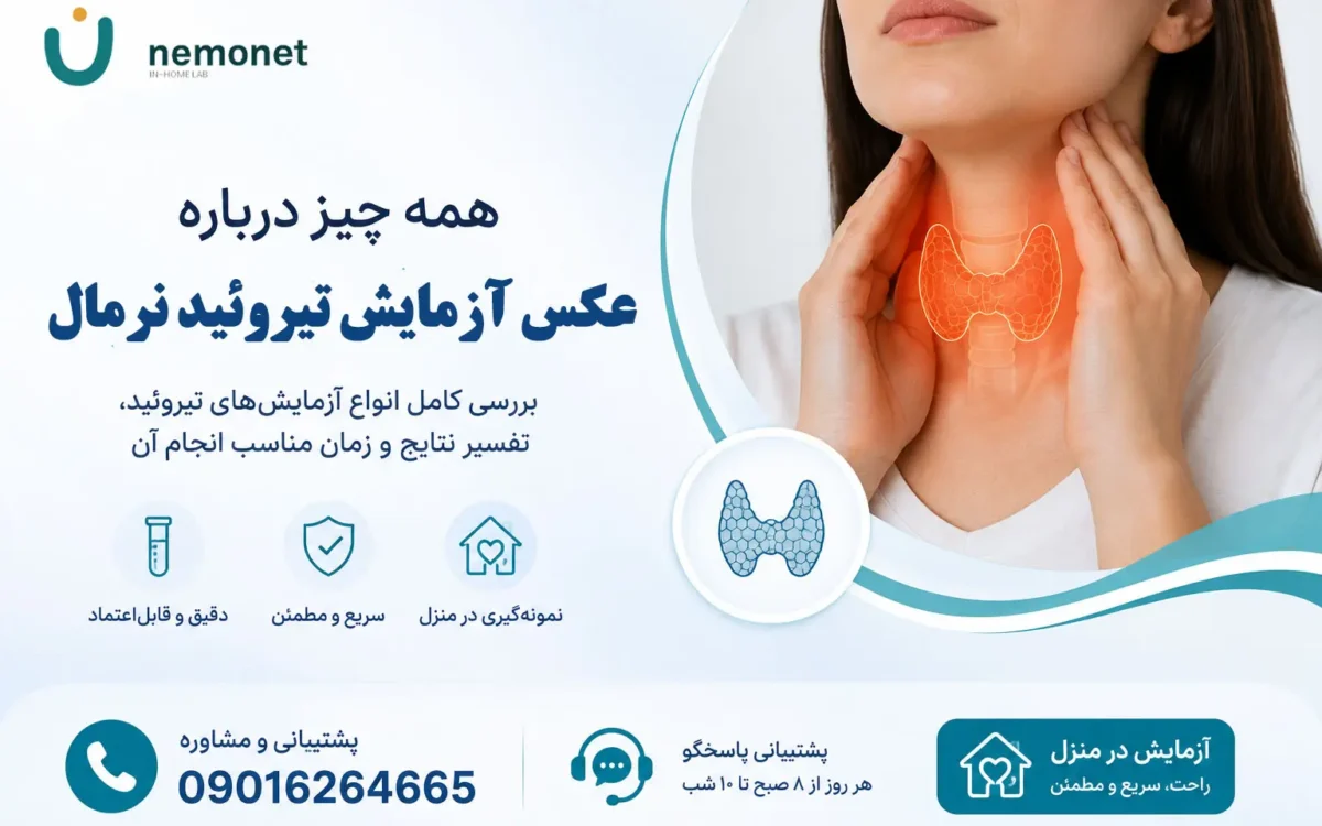 عکس آزمایش تیروئید نرمال