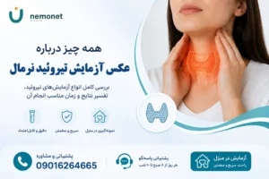 عکس آزمایش تیروئید نرمال